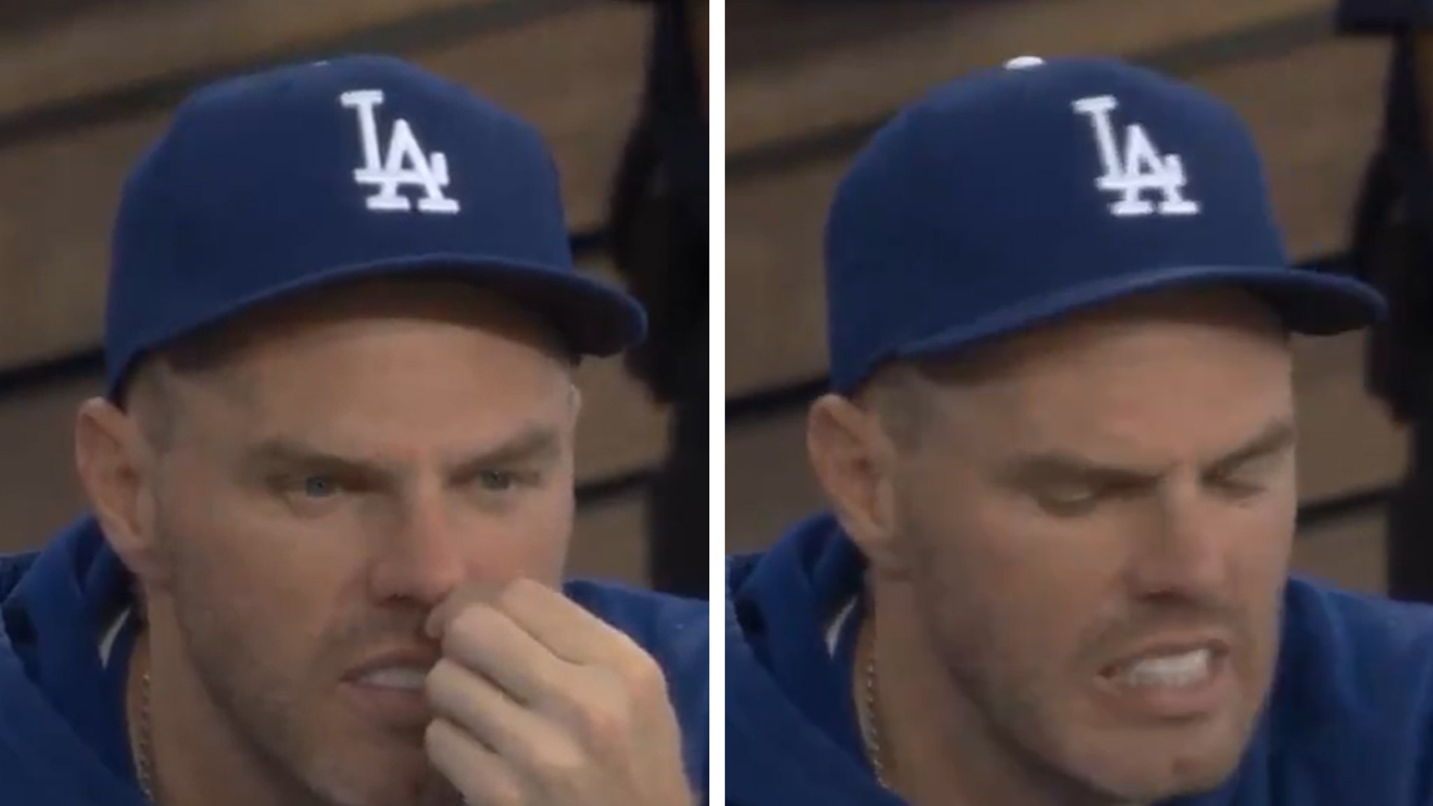 Freddie Freeman Caught On Dodgers Broadcast Ripping Out Nose Hair