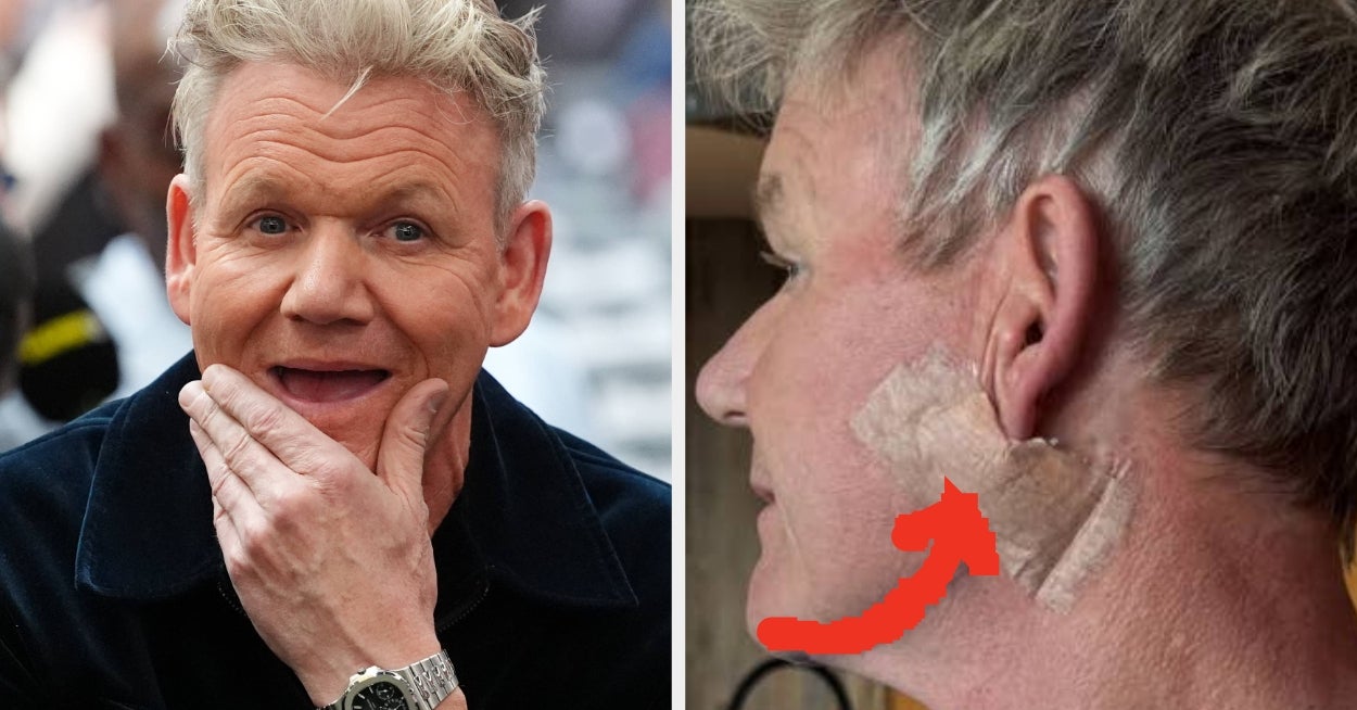 Gordon Ramsay Shares Post-Cancer Treatment Photos