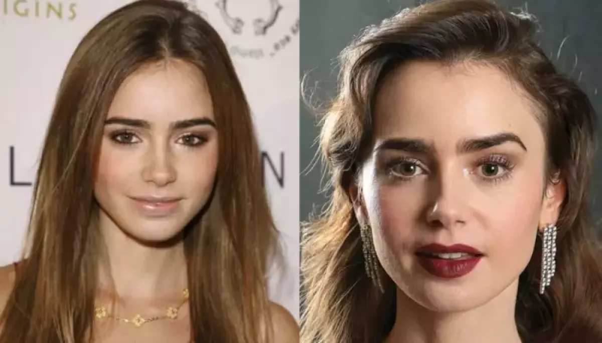 Did Lily Collins Get Cosmetic Surgery? Before-And-After Photos Spark Buzz Amid ‘Bone Diet’ Claims